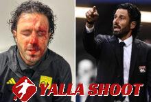 Italy legend Fabio Grosso 'SACKED' a month after being left bloodied by thugs & only 7 games into job at crisis-hit Lyon